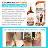 Dr Davey Dark Knuckle Whitening Triple White Serum Get Rid of Knuckies Easily in just 7 days Whitening Complex 50ml